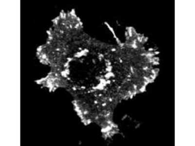 Immunocytochemistry/ Immunofluorescence: ASAP1 [p Tyr782] Antibody [NBP1-77933]